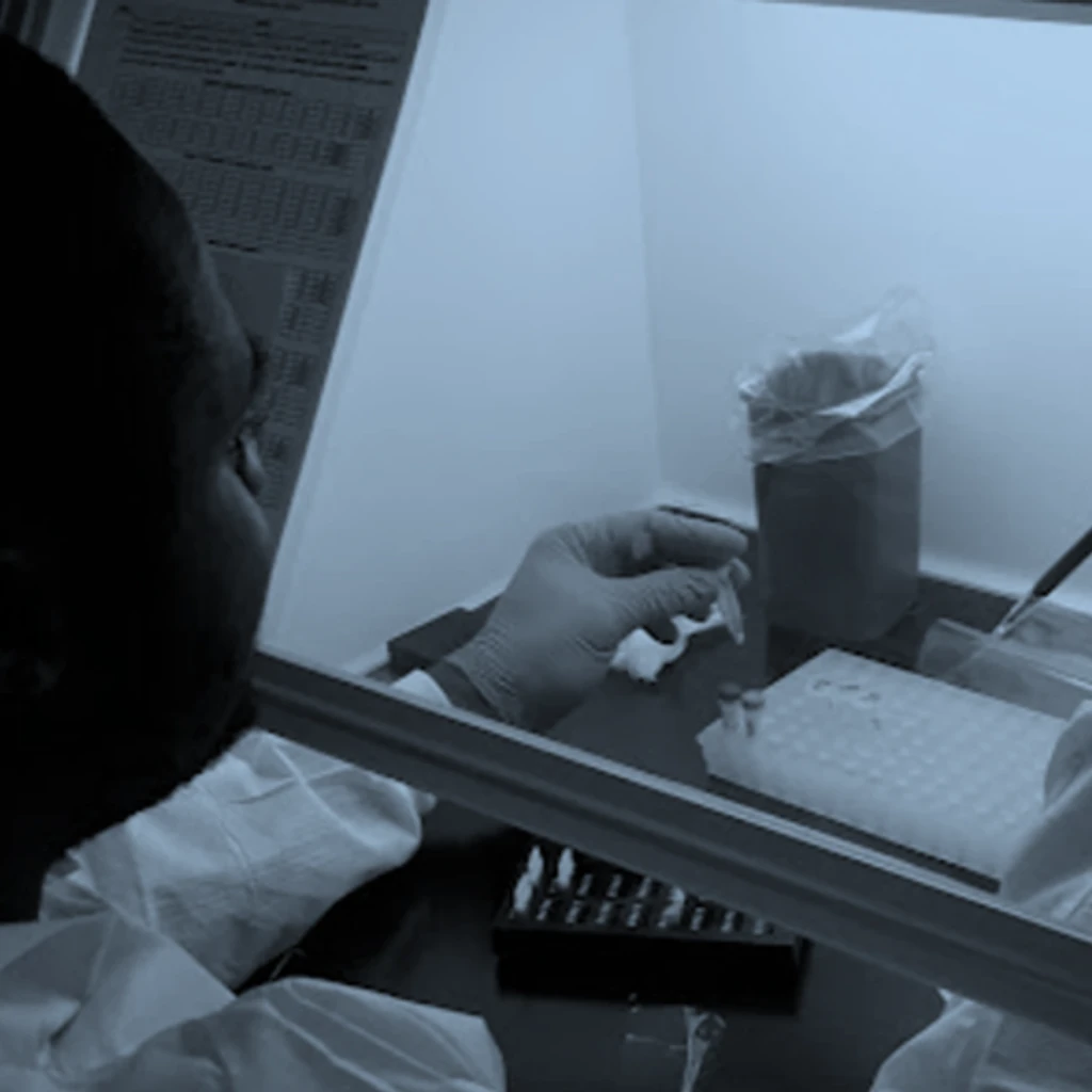 Lassa fever Diagnostics